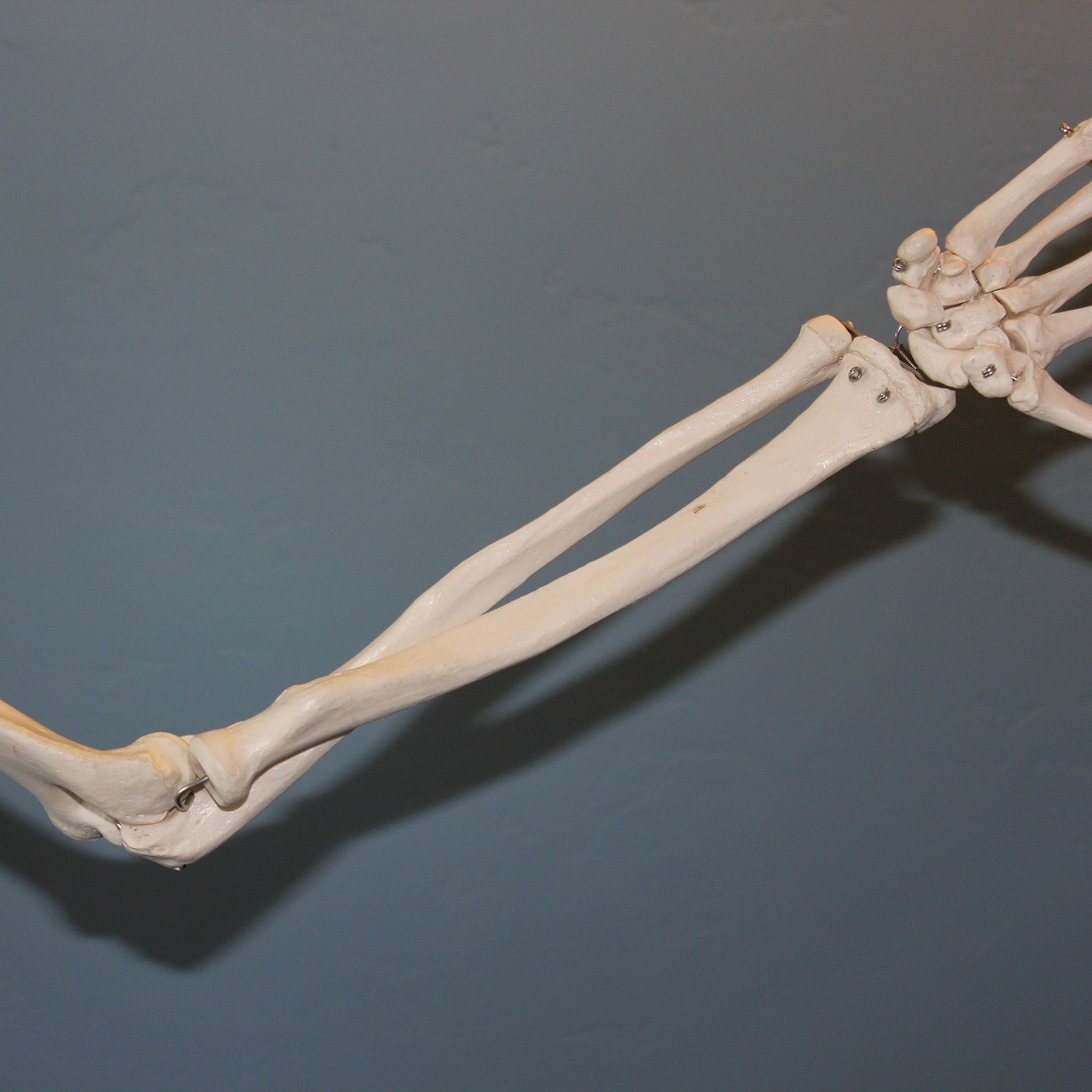 radius ulna underarm attachment