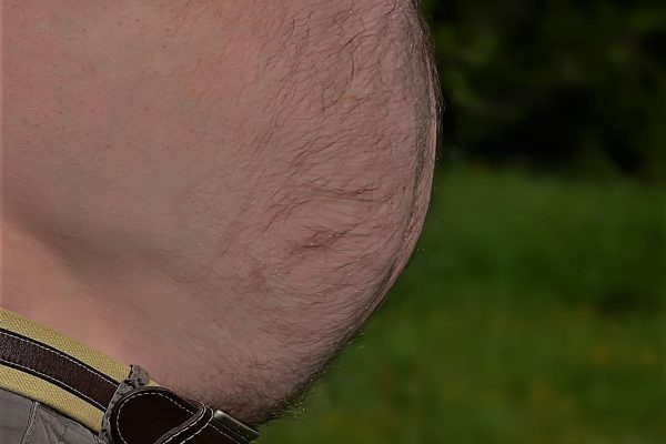 A man with a huge fat belly